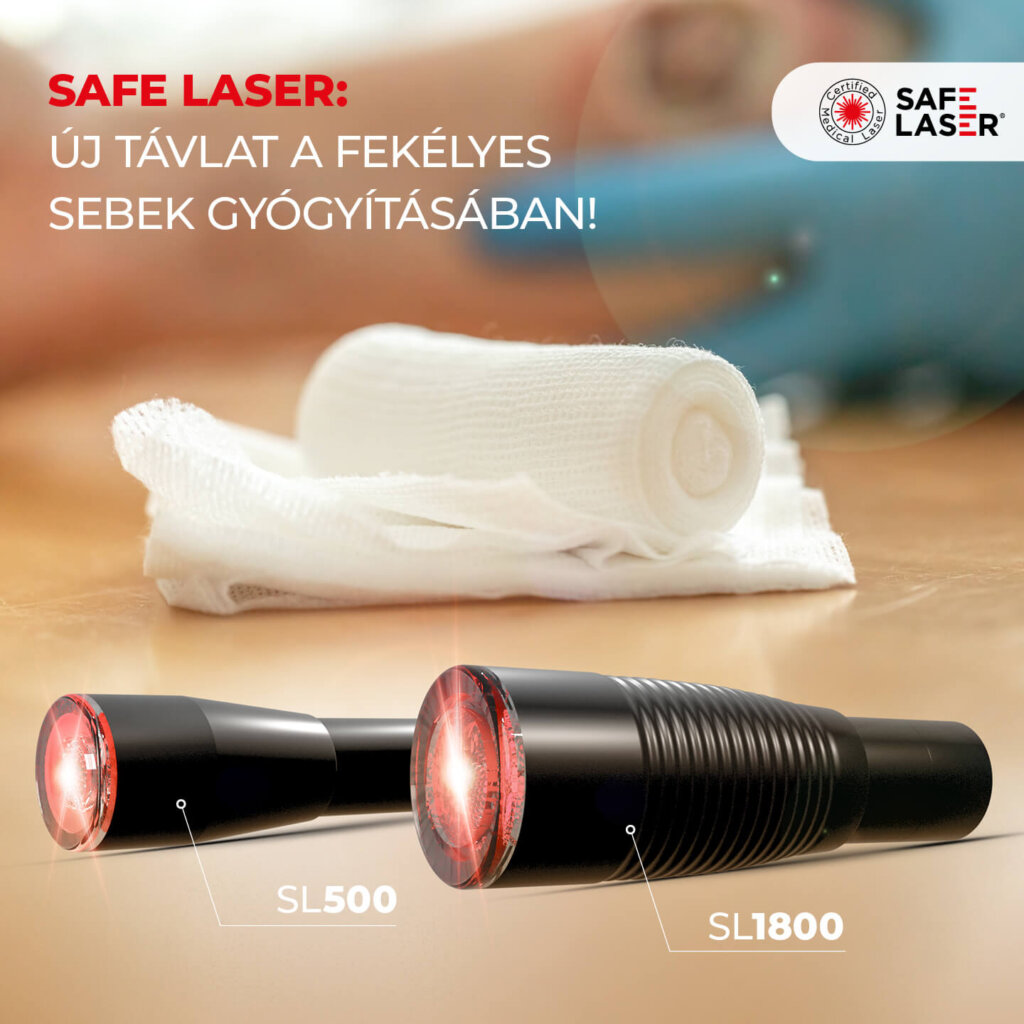 FEKÉLYES SEB KEZELÉSE: SZÉP EREDMÉNYEK A SAFE LASERREL 1 52265a41 769e 4f1a 993a bdcc20c6e3d7 1